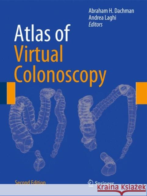 Atlas of Virtual Colonoscopy Abraham H. Dachman Andrea Laghi 9781441958518 Not Avail - książka