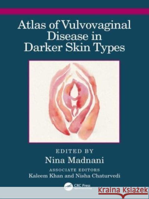 Atlas of Vulvovaginal Disease in Darker Skin Types  9781032255880 Taylor & Francis Ltd - książka