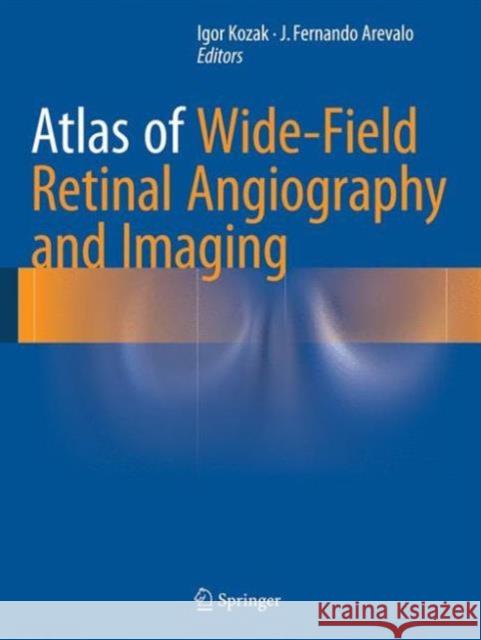 Atlas of Wide-Field Retinal Angiography and Imaging J. Fernando Arevalo Igor Kozak 9783319178639 Springer - książka