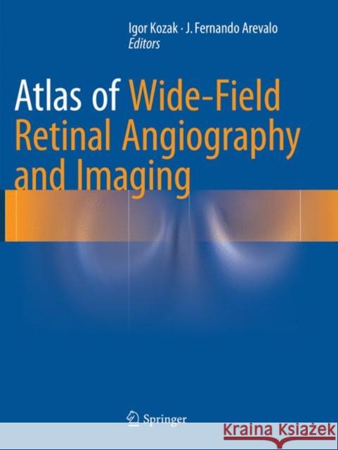 Atlas of Wide-Field Retinal Angiography and Imaging  9783319792408 Springer - książka