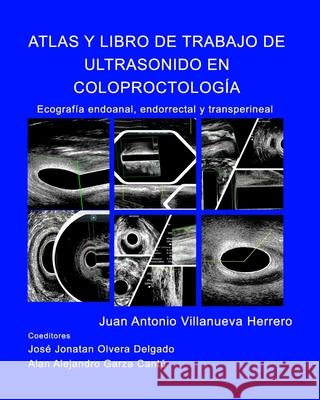 Atlas y Libro de Trabajo de Ultrasonido en Coloproctología: Ecografia endoanal, endorrectal y transperineal Herrero, Juan a. Villanueva 9781714392544 Blurb - książka