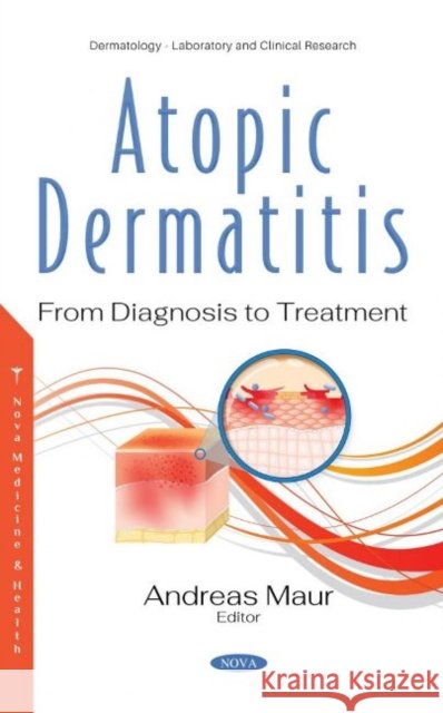 Atopic Dermatitis  9781536185201 Nova Science Publishers Inc - książka