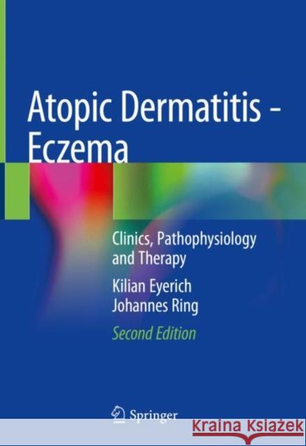 Atopic Dermatitis - Eczema: Clinics, Pathophysiology and Therapy Johannes Ring 9783031124983 Springer International Publishing AG - książka
