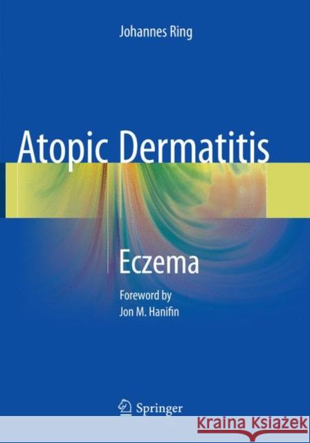 Atopic Dermatitis: Eczema Ring, Johannes 9783319793849 Springer - książka