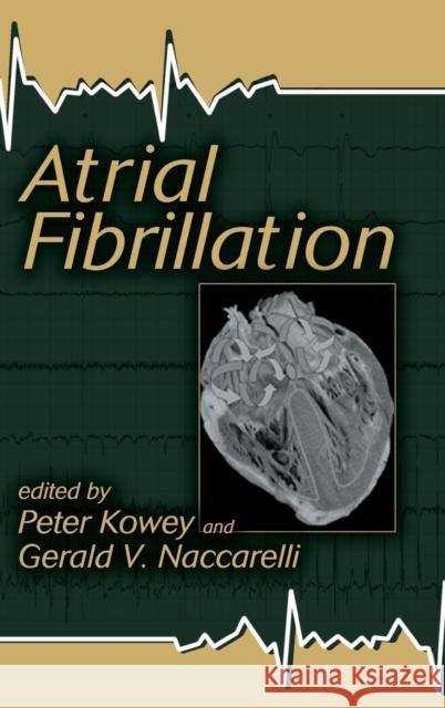 Atrial Fibrillation Gerald V. Nacarelli Peter R. Kowey Gerald V. Naccarelli 9780824754105 Marcel Dekker - książka