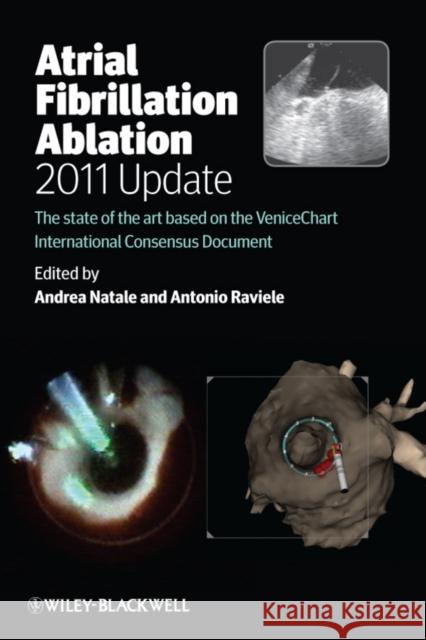 Atrial Fibrillation Ablation, 2011 Update: The State of the Art Based on the Venicechart International Consensus Document Natale, Andrea 9780470674154  - książka
