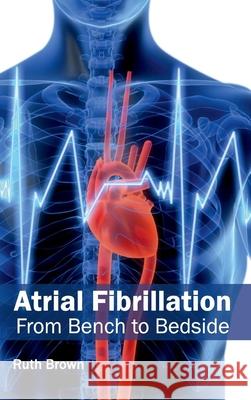 Atrial Fibrillation: From Bench to Bedside Ruth Brown 9781632410504 Hayle Medical - książka