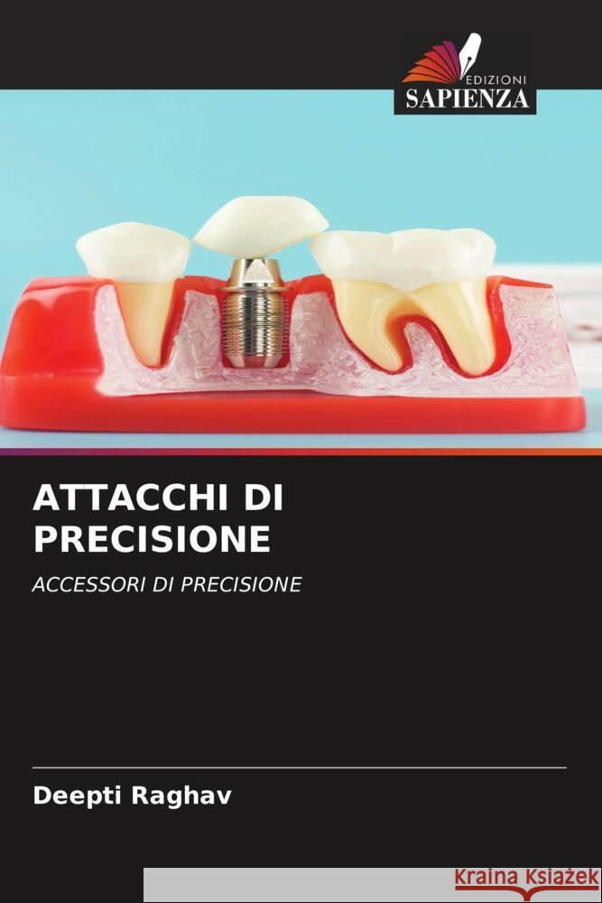 ATTACCHI DI PRECISIONE Raghav, Deepti 9786204608303 Edizioni Sapienza - książka