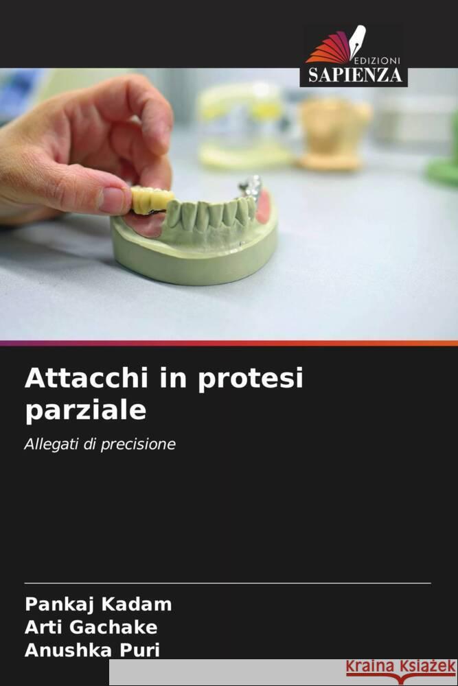 Attacchi in protesi parziale Kadam, Pankaj, GACHAKE, ARTI, PURI, ANUSHKA 9786205162385 Edizioni Sapienza - książka