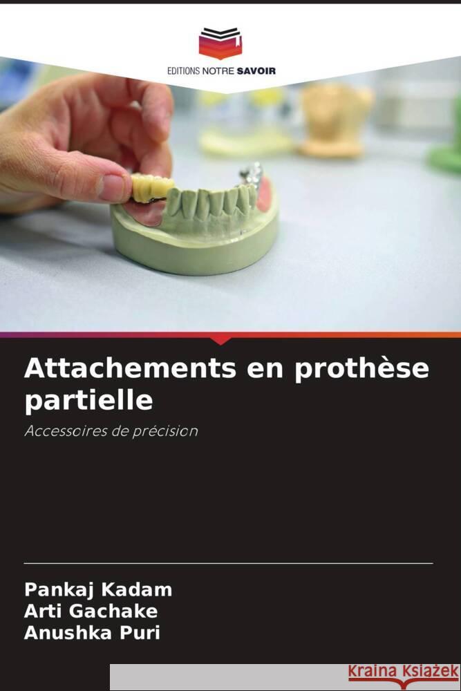 Attachements en prothèse partielle Kadam, Pankaj, GACHAKE, ARTI, PURI, ANUSHKA 9786205162378 Editions Notre Savoir - książka