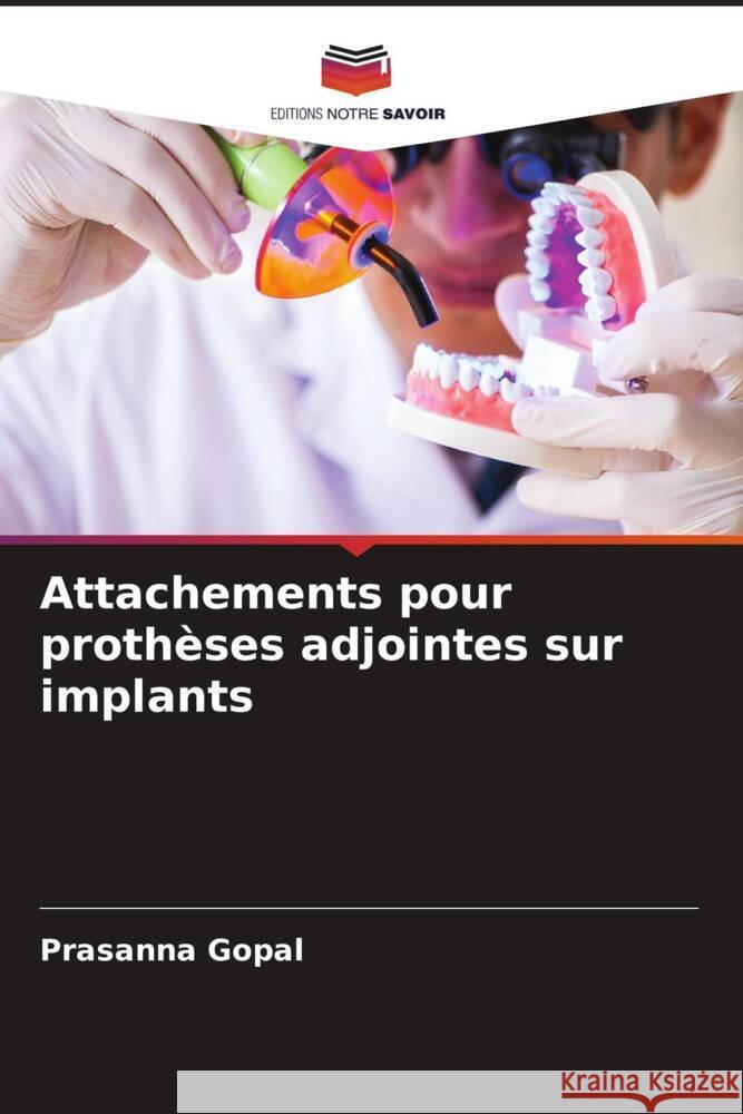 Attachements pour prothèses adjointes sur implants Gopal, Prasanna 9786205547984 Editions Notre Savoir - książka