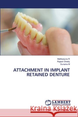 Attachment in Implant Retained Denture R, Mallikarjuna, Shetty, Rajesh, M, Sunaina 9786209828546 LAP Lambert Academic Publishing - książka