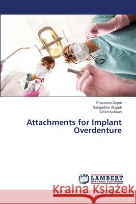 Attachments for Implant Overdenture Gopal, Prasanna; Angadi, Gangadhar; Kubsad, Girish 9786139853588 LAP Lambert Academic Publishing - książka