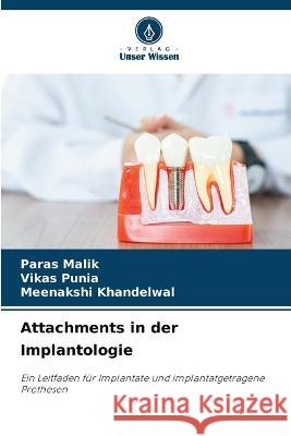 Attachments in der Implantologie Paras Malik Vikas Punia Meenakshi Khandelwal 9786206117322 Verlag Unser Wissen - książka