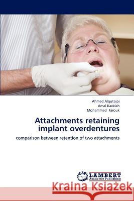 Attachments retaining implant overdentures Alqutaipi, Ahmed 9783659187483 LAP Lambert Academic Publishing - książka