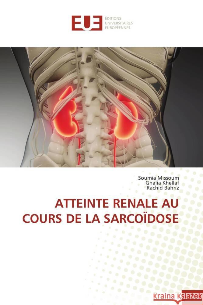 ATTEINTE RENALE AU COURS DE LA SARCOÏDOSE MISSOUM, Soumia, KHELLAF, Ghalia, Bahriz, Rachid 9786206697664 Éditions universitaires européennes - książka