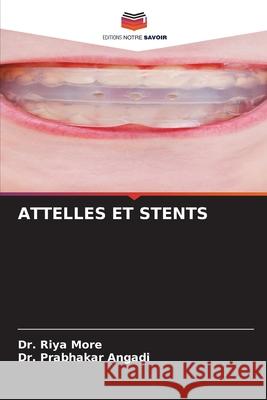 Attelles Et Stents Riya More Prabhakar Angadi 9786207779710 Editions Notre Savoir - książka