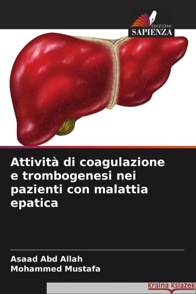Attività di coagulazione e trombogenesi nei pazienti con malattia epatica Abd Allah, Asaad, Mustafa, Mohammed 9786208183172 Edizioni Sapienza - książka