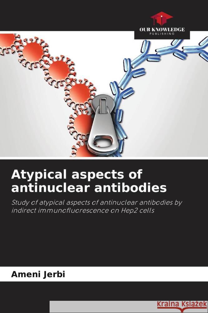 Atypical aspects of antinuclear antibodies Ameni Jerbi 9786208056131 Our Knowledge Publishing - książka