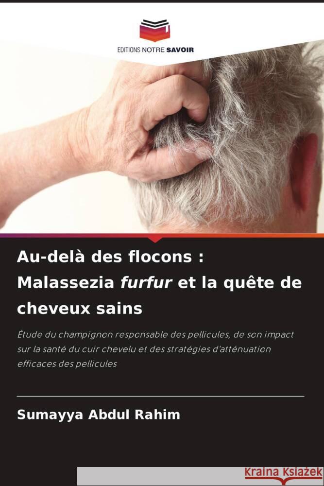 Au-delà des flocons : Malassezia furfur et la quête de cheveux sains Abdul Rahim, Sumayya 9786208584092 Editions Notre Savoir - książka