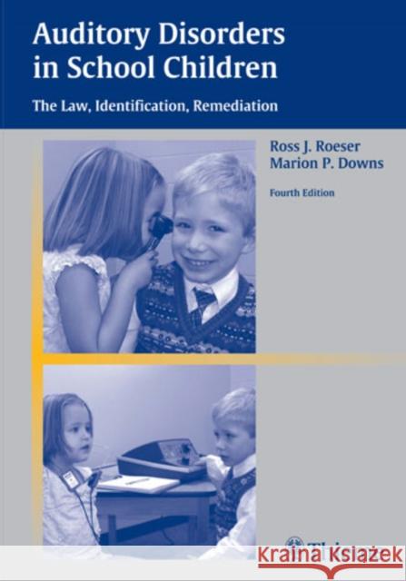 Auditory Disorders in School Children: The Law, Identification, Remediation Roeser, Ross J. 9781588902283 Thieme Medical Publishers - książka