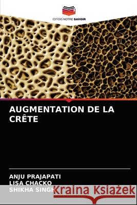 Augmentation de la Crête Prajapati, Anju 9786204076003 Editions Notre Savoir - książka