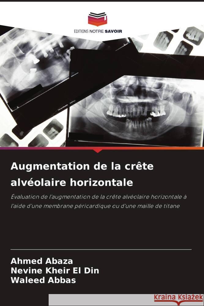 Augmentation de la crête alvéolaire horizontale Abaza, Ahmed, Kheir El Din, Nevine, Abbas, Waleed 9786206397939 Editions Notre Savoir - książka