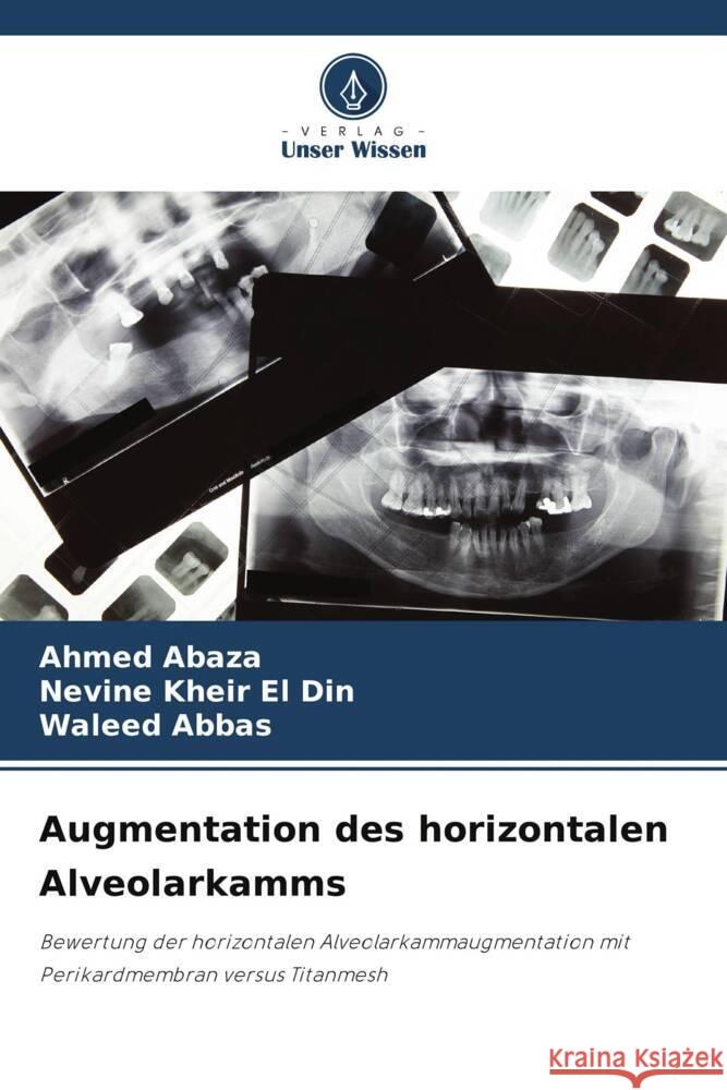 Augmentation des horizontalen Alveolarkamms Abaza, Ahmed, Kheir El Din, Nevine, Abbas, Waleed 9786206397809 Verlag Unser Wissen - książka