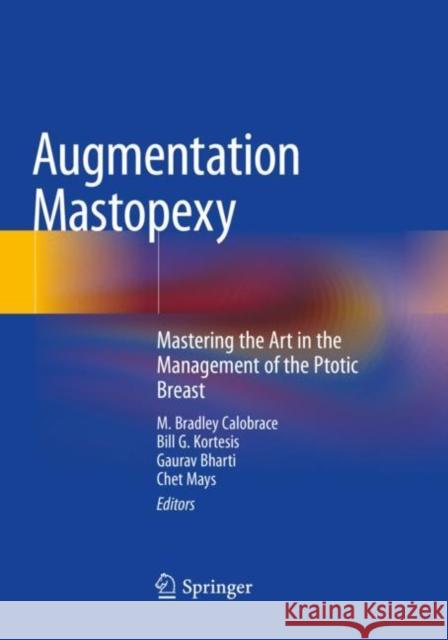 Augmentation Mastopexy: Mastering the Art in the Management of the Ptotic Breast Calobrace, M. Bradley 9783030482282 Springer International Publishing - książka