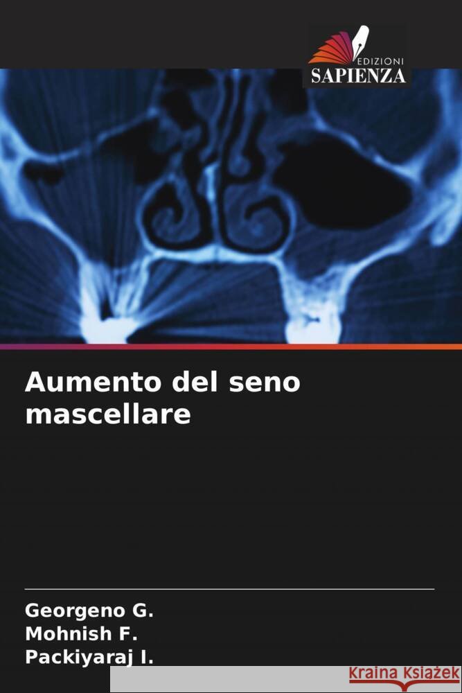 Aumento del seno mascellare Georgeno G Mohnish F Packiyaraj I 9786206653745 Edizioni Sapienza - książka
