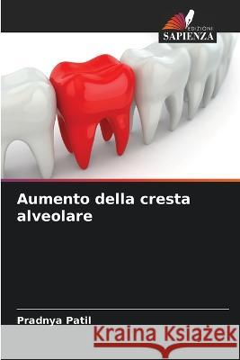 Aumento della cresta alveolare Pradnya Patil   9786206071822 Edizioni Sapienza - książka