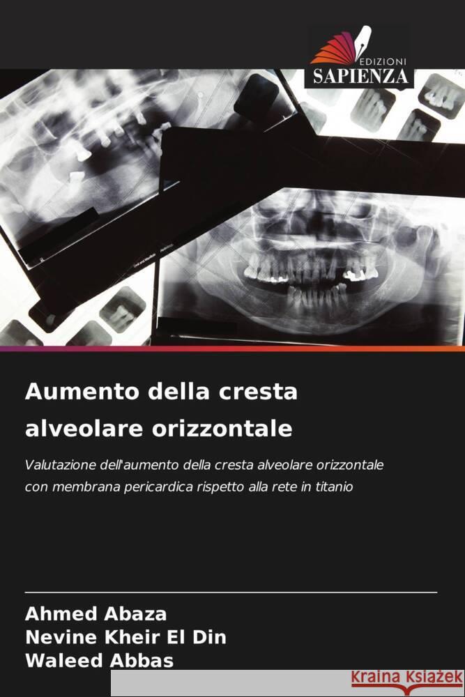 Aumento della cresta alveolare orizzontale Abaza, Ahmed, Kheir El Din, Nevine, Abbas, Waleed 9786206397946 Edizioni Sapienza - książka