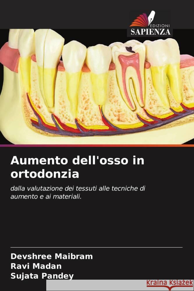 Aumento dell'osso in ortodonzia Maibram, Devshree, Madan, Ravi, Pandey, Sujata 9786205362938 Edizioni Sapienza - książka