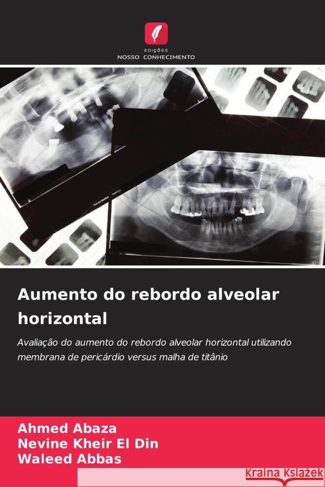 Aumento do rebordo alveolar horizontal Abaza, Ahmed, Kheir El Din, Nevine, Abbas, Waleed 9786206397953 Edições Nosso Conhecimento - książka