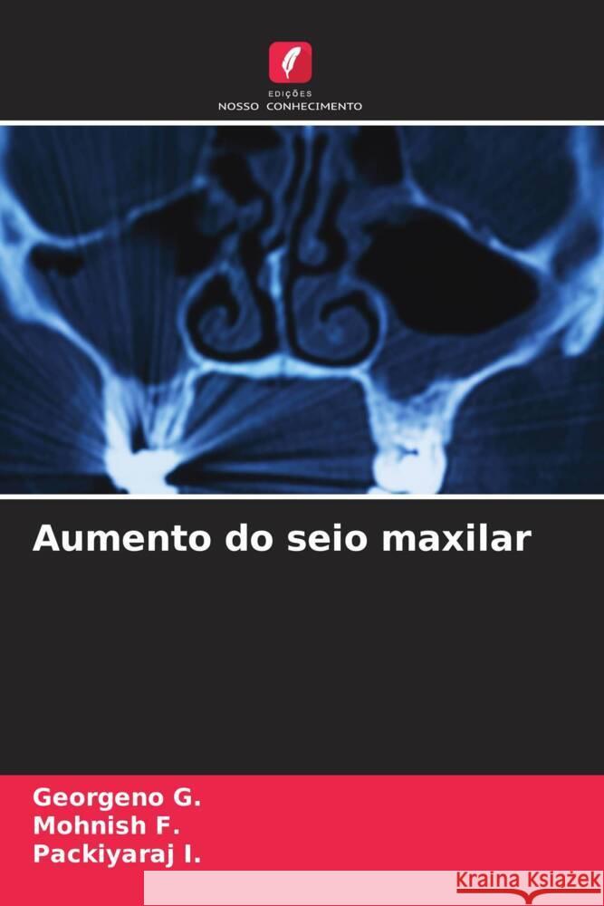 Aumento do seio maxilar Georgeno G Mohnish F Packiyaraj I 9786206653776 Edicoes Nosso Conhecimento - książka