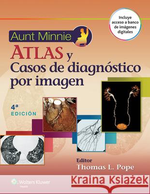 Aunt Minnie. Atlas Y Casos de Diagnóstico Por Imagen Pope, Thomas L. 9788416004720 Lww - książka