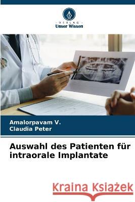 Auswahl des Patienten f?r intraorale Implantate Amalorpavam V Claudia Peter 9786205600054 Verlag Unser Wissen - książka