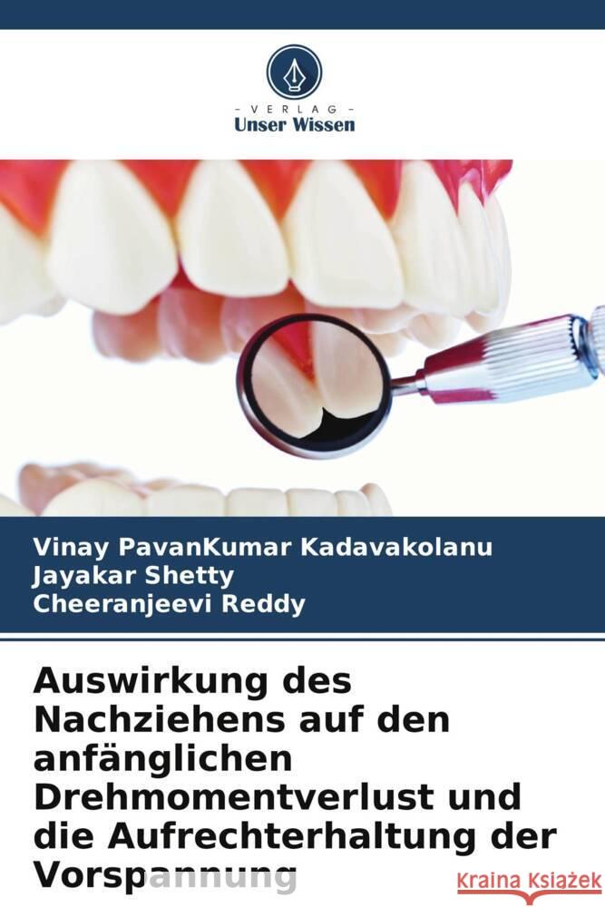 Auswirkung des Nachziehens auf den anf?nglichen Drehmomentverlust und die Aufrechterhaltung der Vorspannung Vinay Pavankumar Kadavakolanu Jayakar Shetty Cheeranjeevi Reddy 9786208129057 Verlag Unser Wissen - książka