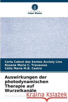 Auswirkungen der photodynamischen Therapie auf Wurzelkanäle Accioly Lins, Carla Cabral dos Santos, Travassos, Rosana Maria C., Castro, Célia Maria M.B. 9786207644001 Verlag Unser Wissen - książka