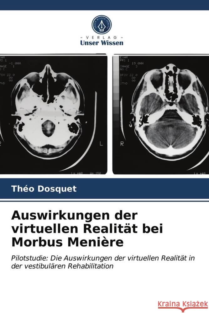 Auswirkungen der virtuellen Realität bei Morbus Menière Dosquet, Théo 9786203978438 Verlag Unser Wissen - książka