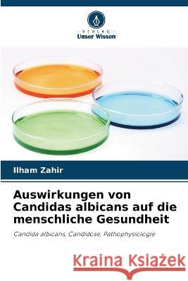 Auswirkungen von Candidas albicans auf die menschliche Gesundheit Ilham Zahir 9786205856680 Verlag Unser Wissen - książka