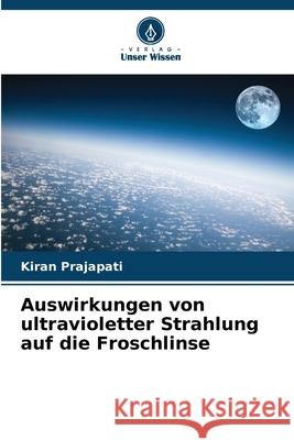 Auswirkungen von ultravioletter Strahlung auf die Froschlinse Kiran Prajapati 9786207734498 Verlag Unser Wissen - książka