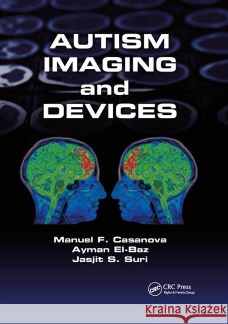 Autism Imaging and Devices Manuel F. Casanova Ayman El-Baz Jasjit S. Suri 9780367872106 CRC Press - książka