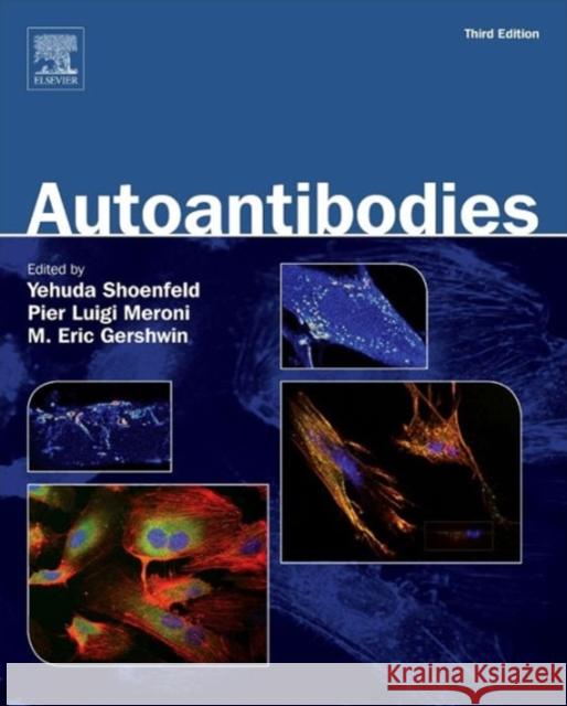 Autoantibodies Shoenfeld, Yehuda Meroni, Pier Luigi Gershwin, M. Eric 9780444563781 Elsevier Science - książka