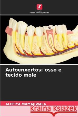 Autoenxertos: osso e tecido mole Alefiya Mamajiwala 9786204050294 Edicoes Nosso Conhecimento - książka