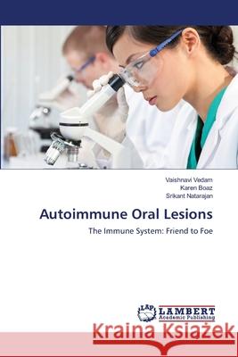 Autoimmune Oral Lesions Vaishnavi Vedam, Karen Boaz, Srikant Natarajan 9783659188978 LAP Lambert Academic Publishing - książka