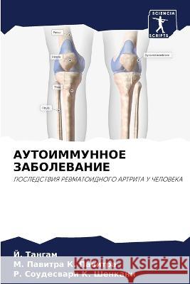 AUTOIMMUNNOE ZABOLEVANIE Tangam, J., K. Pawitra, M. Pawitra, K. Shenkani, R. Soudeswari 9786205896365 Sciencia Scripts - książka