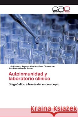 Autoinmunidad y laboratorio clínico Romero Reyes, Luis 9786202122863 Editorial Académica Española - książka
