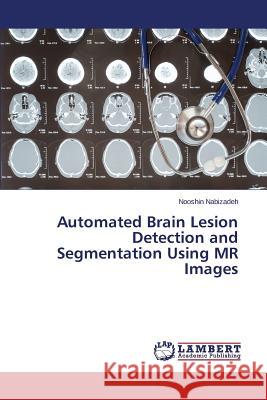 Automated Brain Lesion Detection and Segmentation Using MR Images Nabizadeh Nooshin 9783659717321 LAP Lambert Academic Publishing - książka
