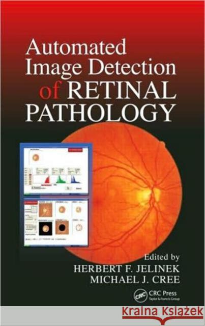 Automated Image Detection of Retinal Pathology Jelinek Jelinek Herbert Jelinek Michael J. Cree 9780849375569 CRC - książka